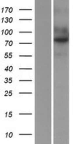Novus Biologicals&trade;&nbsp;Endosialin/CD248/TEM1 Overexpression Lysate