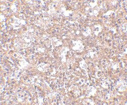 TEM4 Antibody - BSA Free, Novus Biologicals 0.025 mg, Unconjugated:Antibodies,