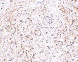 TEM5/GPR124 Antibody - BSA Free, Novus Biologicals 0.1mg; Unlabeled:Antibodies,