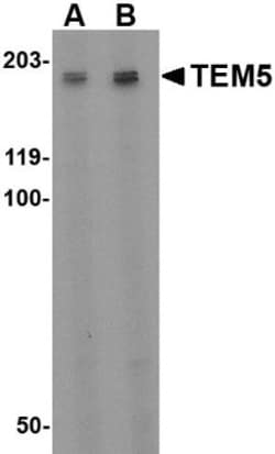 TEM5/GPR124 Antibody - BSA Free, Novus Biologicals 0.1mg; Unlabeled:Antibodies,