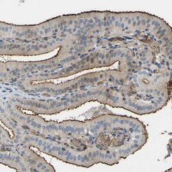 TEM7/PLXDC1 Antibody, Novus Biologicals 0.1mL; Unlabeled:Antibodies, Polyclonal