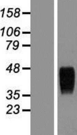 Novus Biologicals&trade;&nbsp;TEM8/ANTXR1 Overexpression Lysate