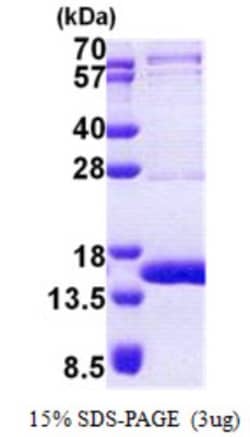 Novus Biologicals&trade;&nbsp;Recombinant Human TEN1 His Protein