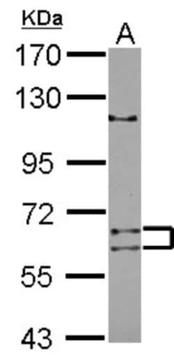 TENR Antibody, Novus Biologicals 0.1mL; Unlabeled:Antibodies, Polyclonal