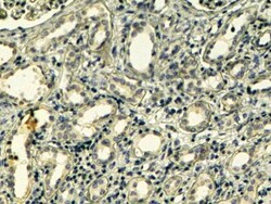 Tensin 1 Antibody, Novus Biologicals 0.1mg; Unlabeled:Antibodies, Polyclonal