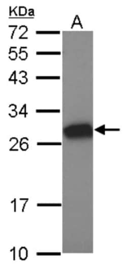 Tesmin Antibody, Novus Biologicals 0.1mL; Unlabeled:Antibodies, Polyclonal