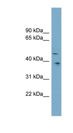 Testican 3/SPOCK3 Antibody, Novus Biologicals 100&mu;L; Unlabeled:Antibodies,