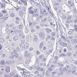 Testis serine protease 5 Antibody, Novus Biologicals 0.1mL; Unlabeled:Antibodies,