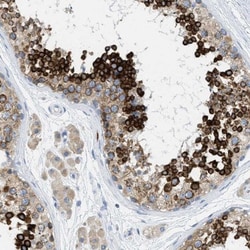 Testis expressed 264 Antibody, Novus Biologicals 25 &mu;L; Unlabeled:Antibodies,