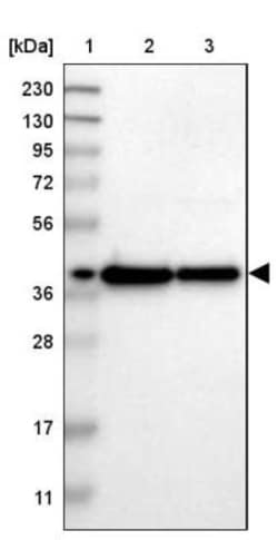 Testis expressed 264 Antibody, Novus Biologicals 25 &mu;L; Unlabeled:Antibodies,