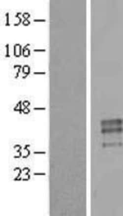 Novus Biologicals&trade;&nbsp;Testisin/Prss21 Overexpression Lysate