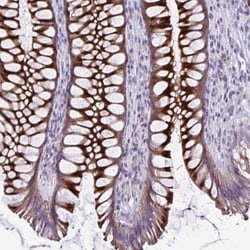 Testis serine protease 5 Antibody, Novus Biologicals 0.1mL; Unlabeled:Antibodies,