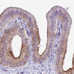Testis serine protease 5 Antibody, Novus Biologicals 0.1mL; Unlabeled:Antibodies,