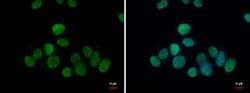 TET1 Antibody, Novus Biologicals 0.1mL; Unlabeled:Antibodies, Polyclonal