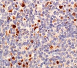 TET1 Antibody - BSA Free, Novus Biologicals 0.1mL; Unlabeled:Antibodies,