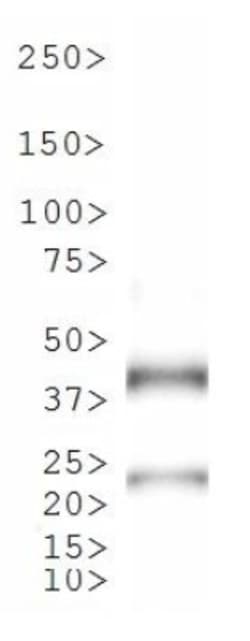 TetR Antibody - BSA Free, Novus Biologicals 0.025mL; Unlabeled:Antibodies,