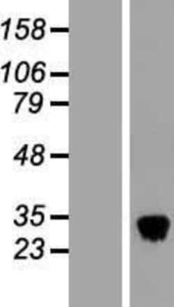 Novus Biologicals&trade;&nbsp;CLEC3B/Tetranectin Overexpression Lysate