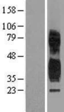 Novus Biologicals&trade;&nbsp;TSPAN1 Overexpression Lysate