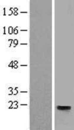 Novus Biologicals&trade;&nbsp;Tetraspanin-31 Overexpression Lysate