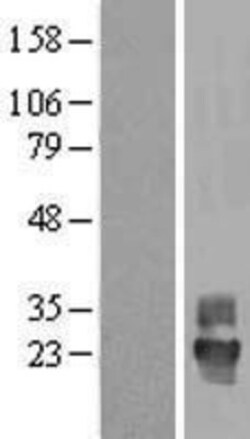 Novus Biologicals&trade;&nbsp;Tetraspanin-4 Overexpression Lysate