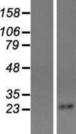 Novus Biologicals™ Tetraspanin-4 Overexpression Lysate
