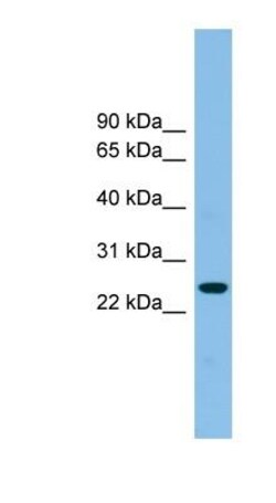 Tetraspanin-4 Antibody, Novus Biologicals 100&mu;L; Unlabeled:Antibodies,