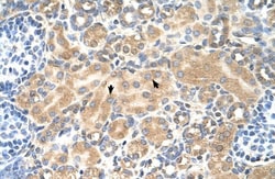 Tetraspanin-5 Antibody, Novus Biologicals 0.05mg; Unlabeled:Antibodies,