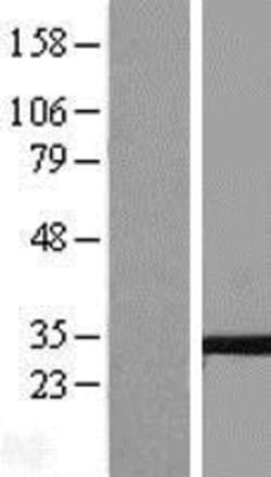 Novus Biologicals™ Tetraspanin-5 Overexpression Lysate