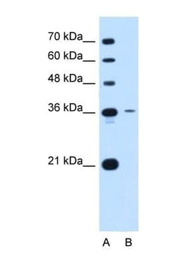 Tetraspanin-5 Antibody, Novus Biologicals 0.05mg; Unlabeled:Antibodies,