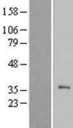 Novus Biologicals™ TEX101 Overexpression Lysate