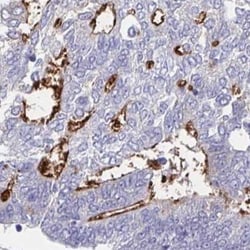 TEX12 Antibody, Novus Biologicals 25 &mu;L, Unlabeled:Antibodies, Polyclonal