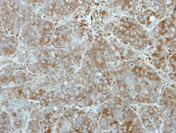 Tex14 Antibody, Novus Biologicals 0.1 mL | Buy Online | Novus Biologicals | Fisher Scientific
