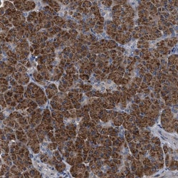 TEX2 Antibody, Novus Biologicals 0.1mL; Unlabeled:Antibodies, Polyclonal
