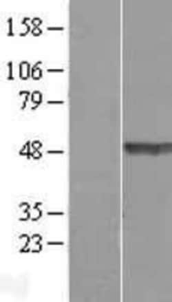 Novus Biologicals&trade;&nbsp;TEX28 Overexpression Lysate