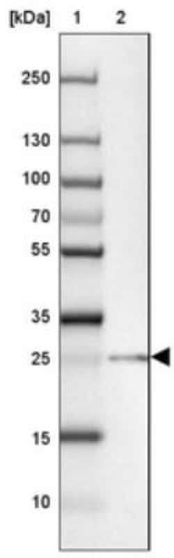 TEX30 Antibody, Novus Biologicals 0.1 mL | Buy Online | Novus Biologicals | Fisher Scientific