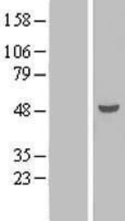 Novus Biologicals™ TEX9 Overexpression Lysate