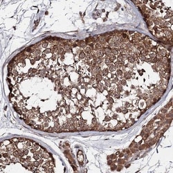 TEX9 Antibody, Novus Biologicals:Antibodies:Primary Antibodies