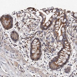 TFB1M Antibody, Novus Biologicals 25 &mu;L, Unlabeled:Antibodies, Polyclonal