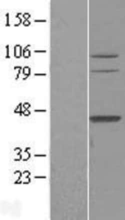 Novus Biologicals&trade;&nbsp;TFB2M Overexpression Lysate