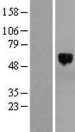 Novus Biologicals™ TFEB Overexpression Lysate