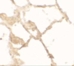 TFEB Antibody - BSA Free, Novus Biologicals:Antibodies:Primary Antibodies