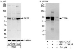 TFEB Antibody, Novus Biologicals 0.1mg; Unlabeled:Antibodies, Polyclonal