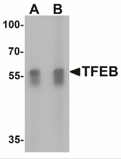 TFEB Antibody - BSA Free, Novus Biologicals:Antibodies:Primary Antibodies