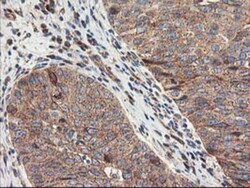 TFG Antibody (OTI2C3), Novus Biologicals 0.1mL; Unlabeled:Antibodies, Monoclonal