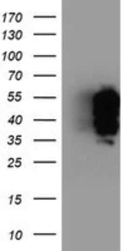 TFG Antibody (OTI2C3), Novus Biologicals 0.1mL; Unlabeled:Antibodies, Monoclonal