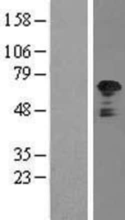 Novus Biologicals™ TFG Overexpression Lysate