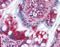 TFG Antibody, Novus Biologicals 0.025mg; Unlabeled:Antibodies, Polyclonal