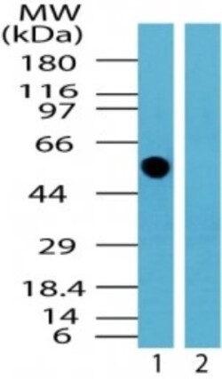 TFG Antibody, Novus Biologicals 0.025mg; Unlabeled:Antibodies, Polyclonal