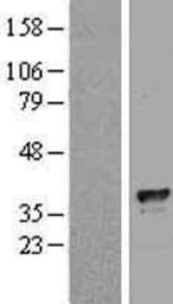 Novus Biologicals™ TFIIB Overexpression Lysate