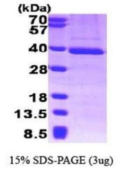 Novus Biologicals&trade;&nbsp;Recombinant Human TFIIB His Protein